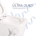 Унітаз підвісний Qtap Tern Ultra Quiet 520×345×325 мм, Marble, з сидінням Slim Duroplast / Soft-close / Quick Release QTTER26MR49002